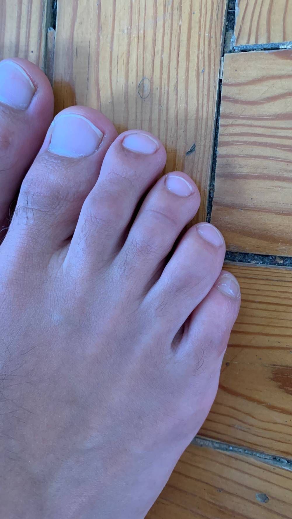 feetbyrodrigo OnlyFans – free nudes, naked, leaked