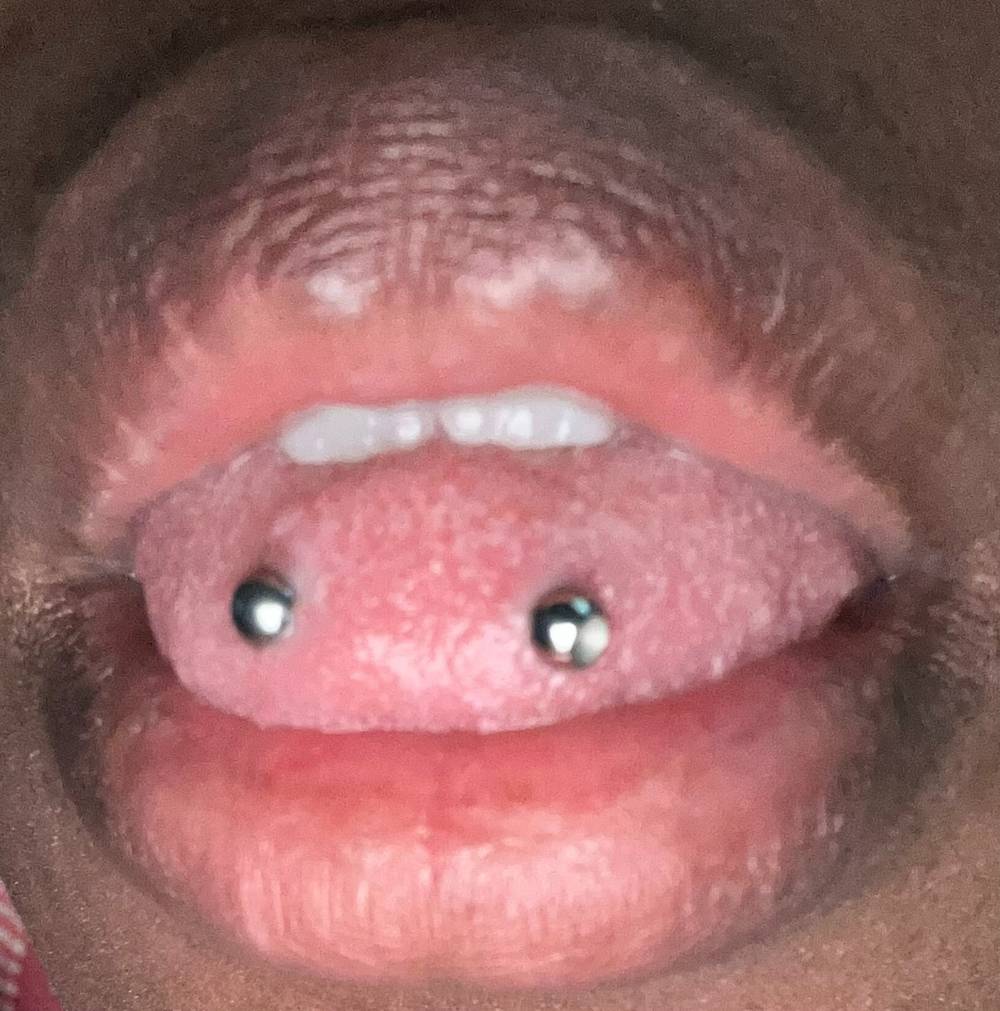 lipsntoes4daze