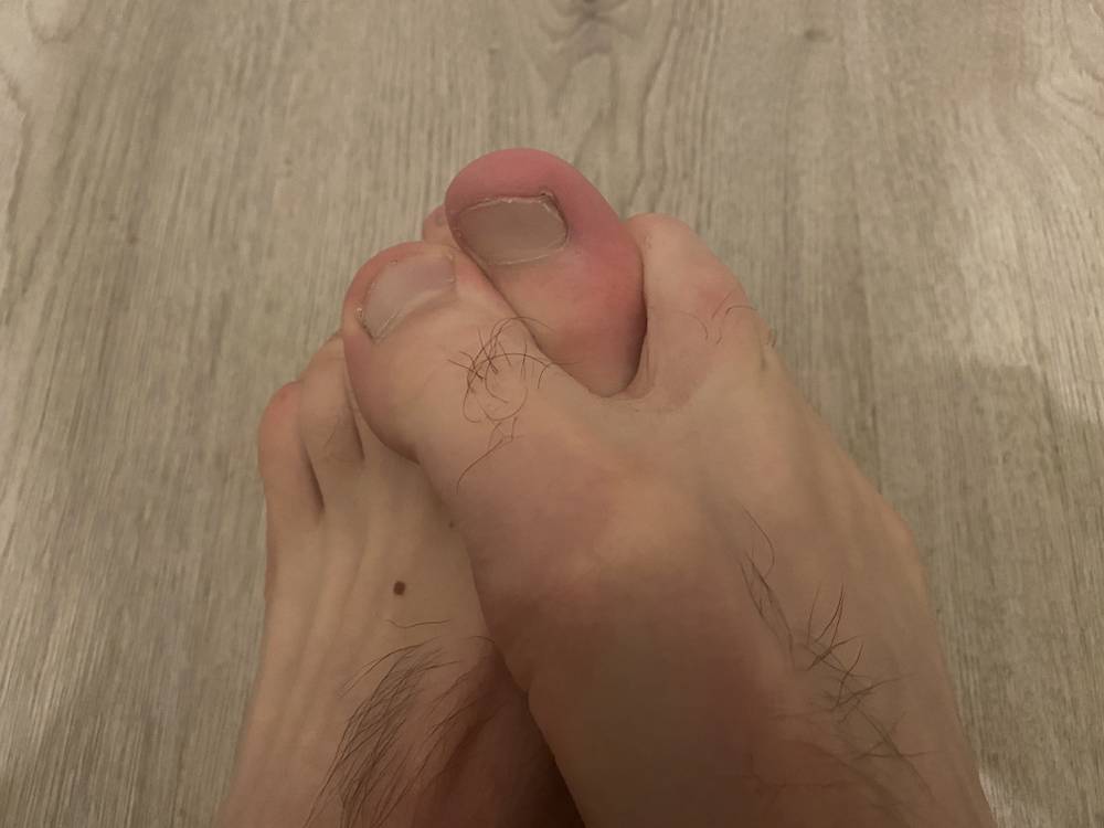 Thomas' feet