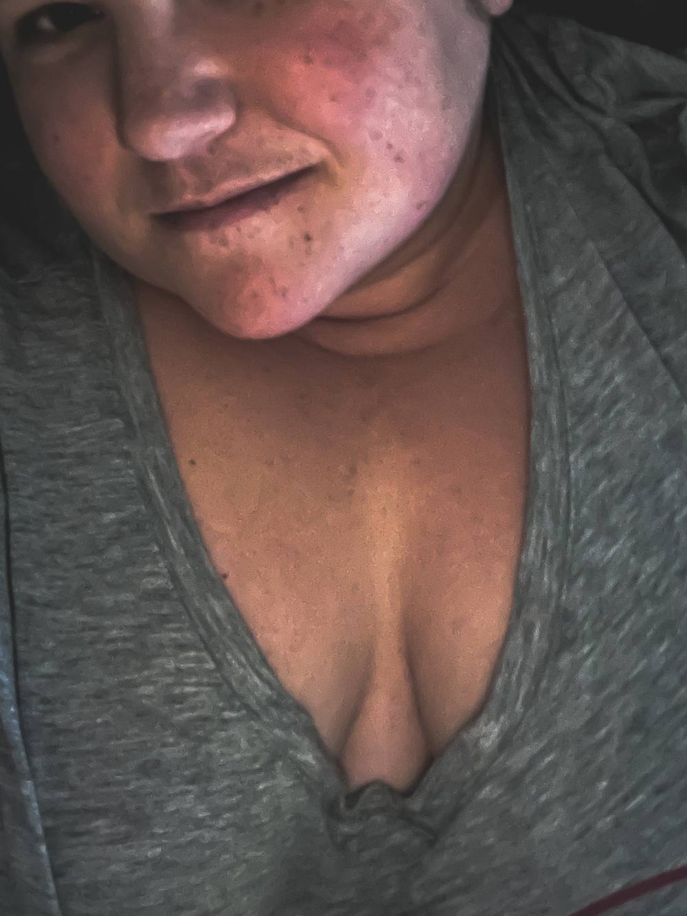 Michelle