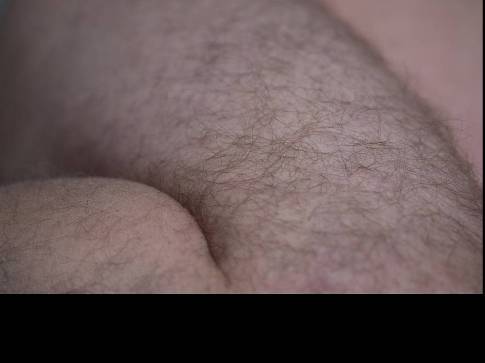 Body hair and dicks