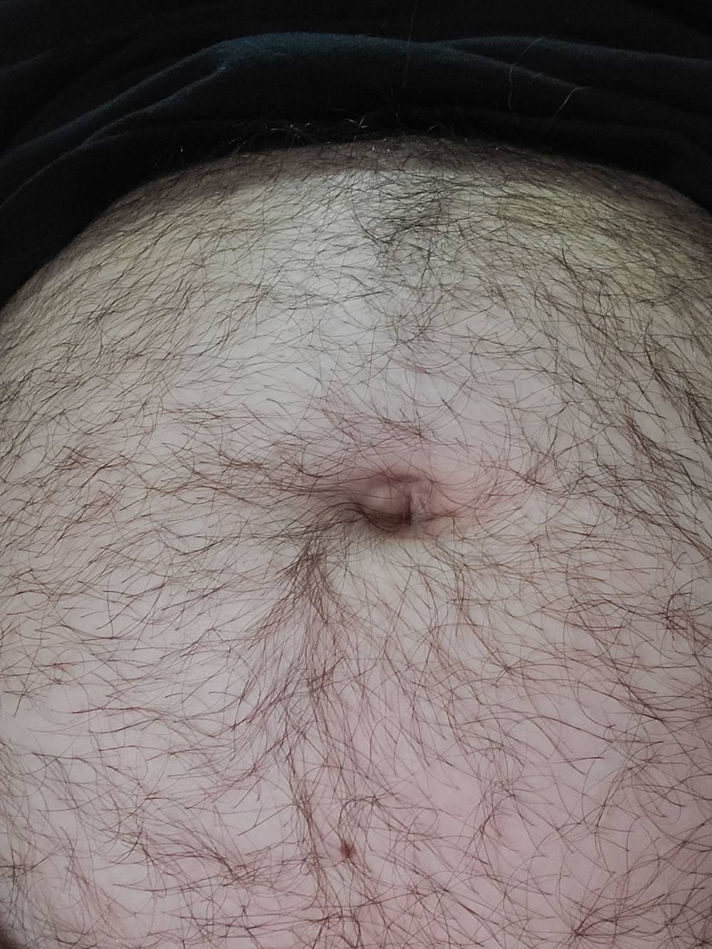 Dad bod belly