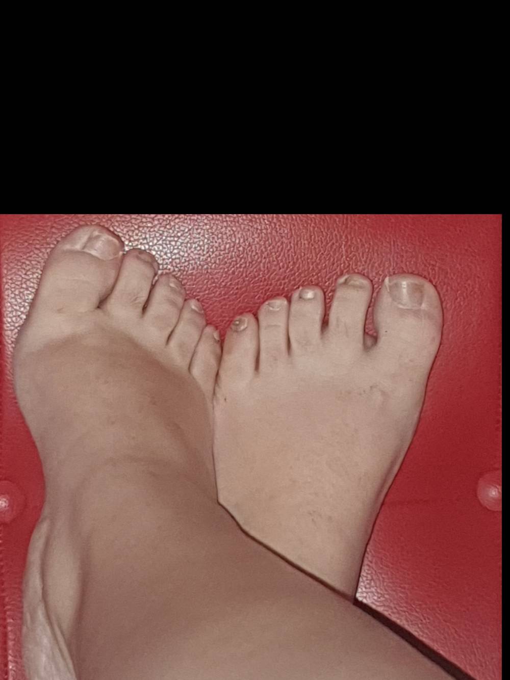 Chubbyfeet