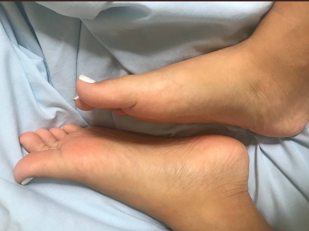 Ri