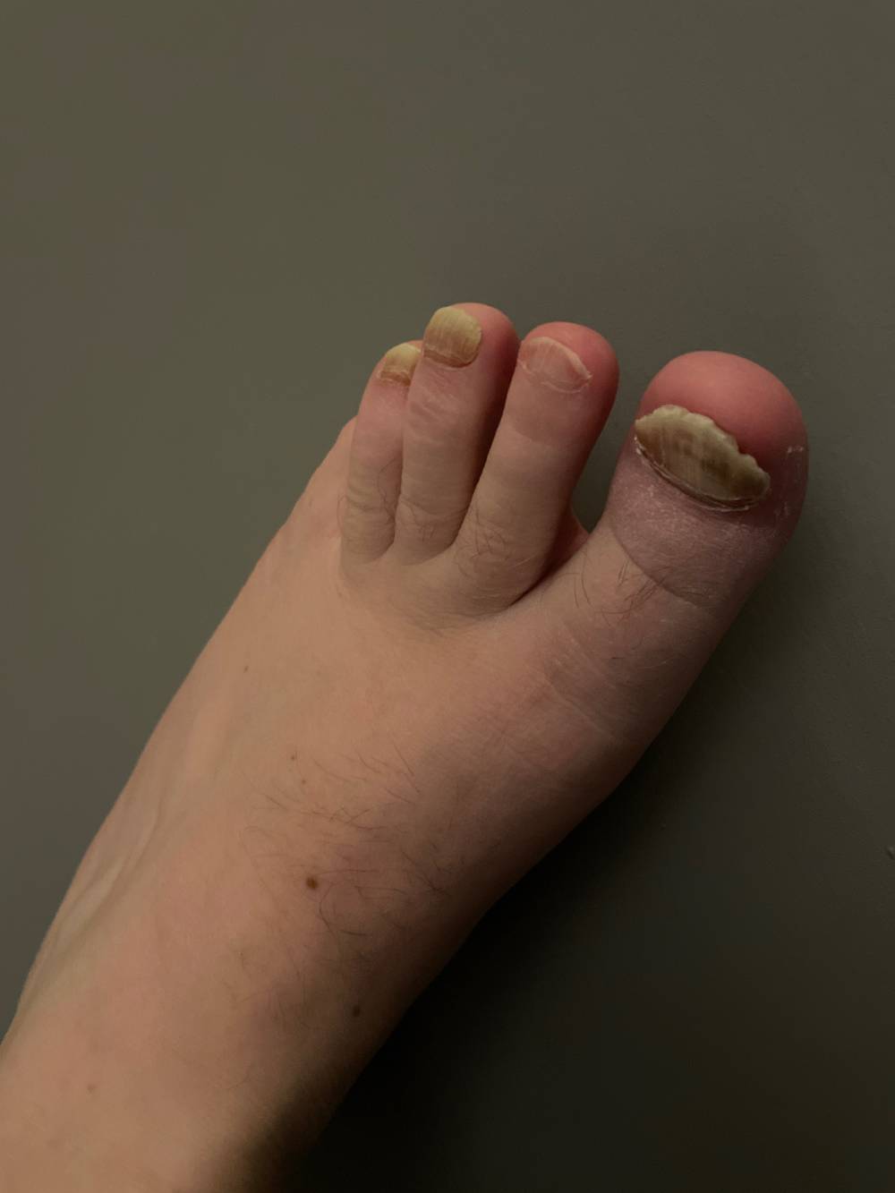 Bacon Feet